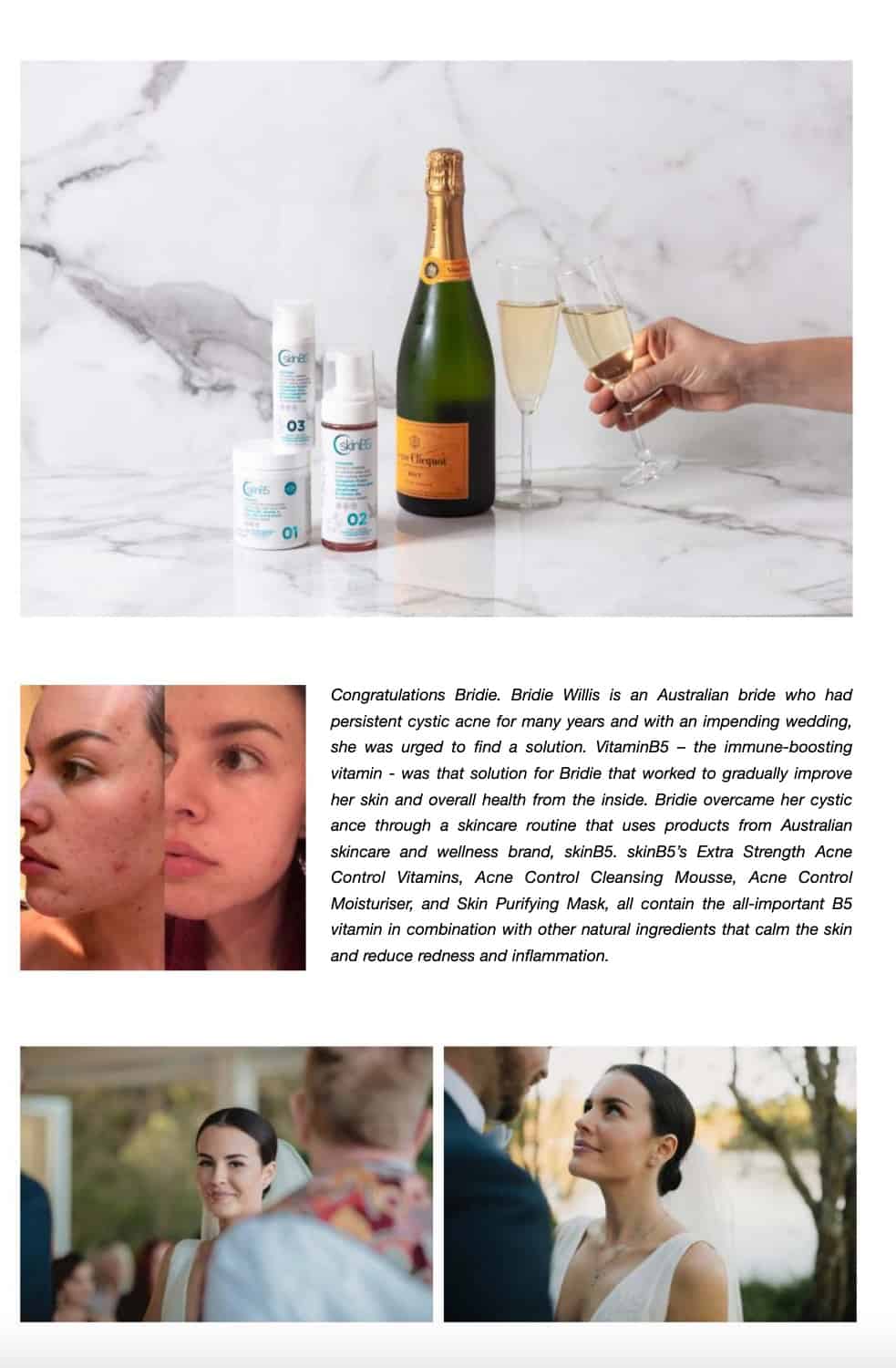 SkinB5 in Same Same Wedding and Brisbane Bride Magazine August 2019